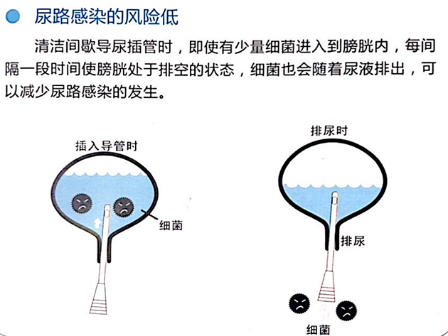 健康宣教清洁间歇导尿技术知多少
